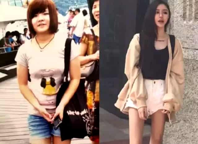 欧尚x5可以加前雷达吗